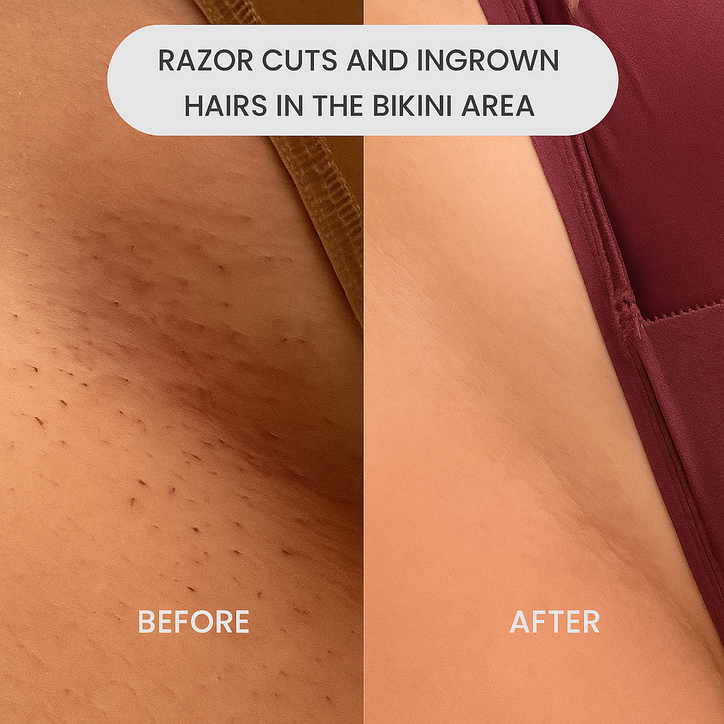 2-in-1 Electric Trimmer for Women