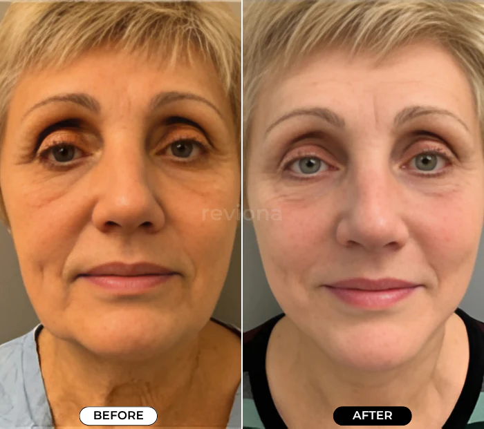 4-in-1 Face Massager